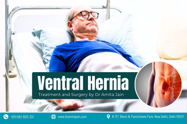 Dr Amita Jain is the best Ventral Hernia specialist and surgeon in Delhi best Ventral Hernia surgeon in Delhi